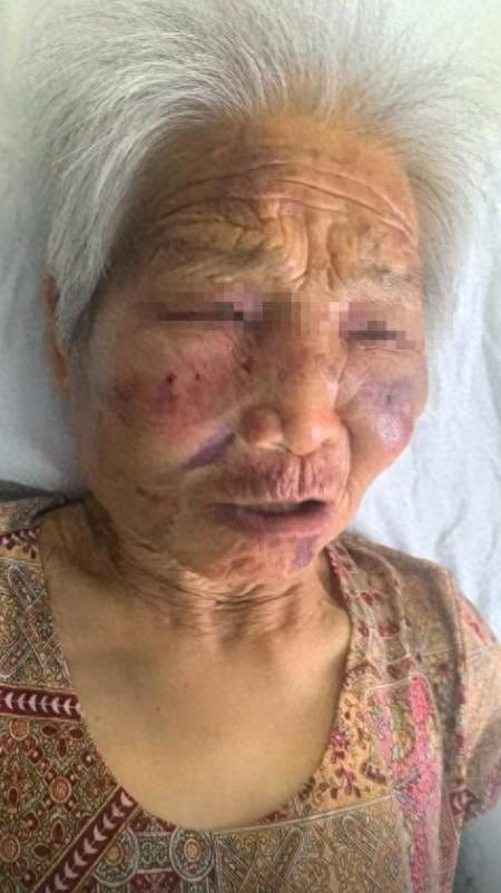 九游游戏-山西养老院暴打85岁老人：打人者真容曝光，身份不一般，官方回应