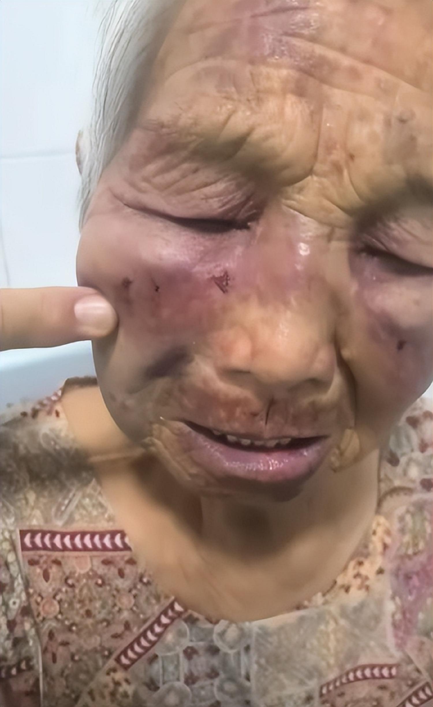 九游游戏-山西养老院暴打85岁老人：打人者真容曝光，身份不一般，官方回应