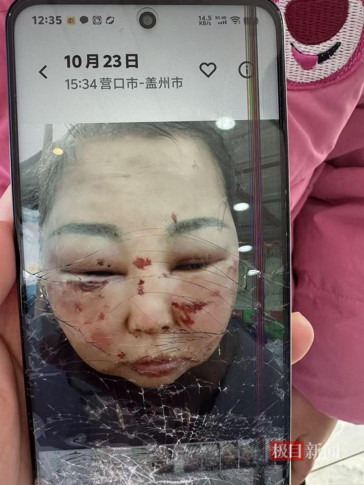 被前夫打进ICU的女子情况仍不稳定,其8岁女儿也曾遭父亲扇脸,律师:已构成故意伤害罪,或同时涉虐待罪