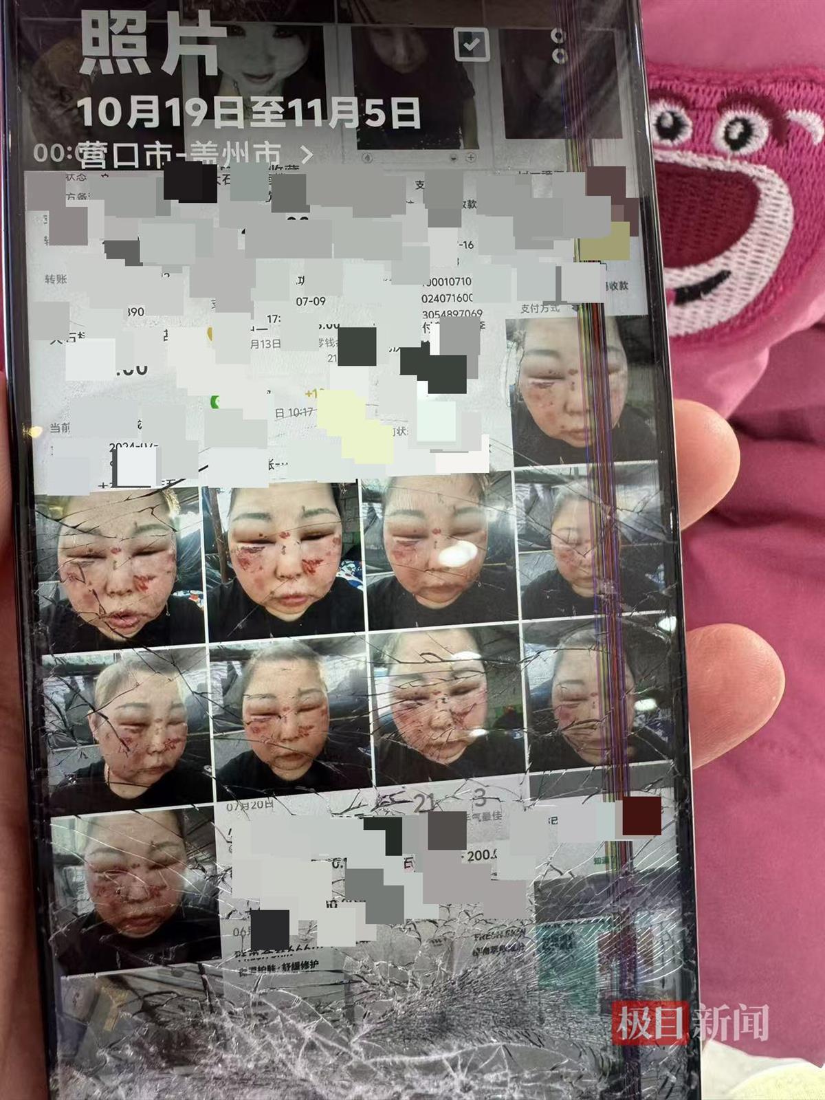 被前夫打进ICU的女子情况仍不稳定,其8岁女儿也曾遭父亲扇脸,律师:已构成故意伤害罪,或同时涉虐待罪